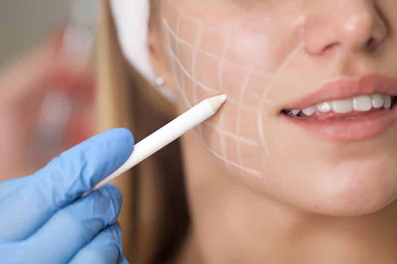 Mapping fillers for face
