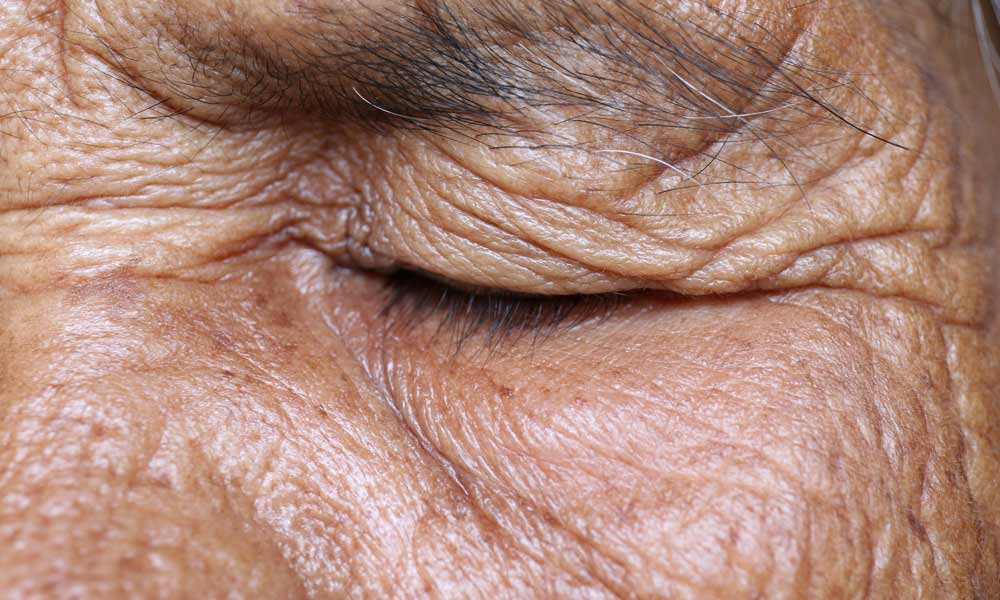 Closeup of Eye with Wrinkles